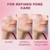 Sérum De Ácido Azelaico 20 G, Reduce Las Imperfecciones