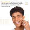 AcneFree Acne Free Terminator Spot Treatment With Benzoyl Peroxide 10%