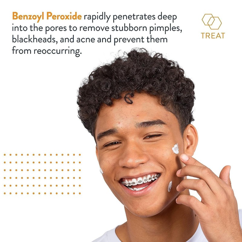 AcneFree Acne Free Terminator Spot Treatment With Benzoyl Peroxide 10%