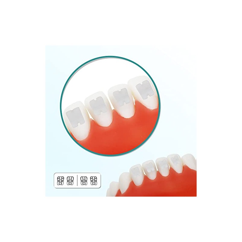 10 Paquetes de Soportes Dentales Cerámicos para Brackets Ortodónticos de