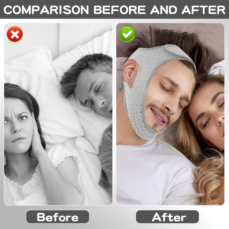 Lunaanda Anti Schnarchen Kinnriemen,Anti Snoring Chin Strap,Schnarchstopper Anti Schnarchen,Kinnband,Anti Schnarch