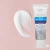 Equate 10% Benzoyl Peroxide Acne Treatment Gel - 2 Pack