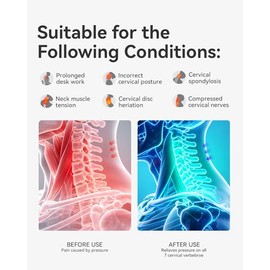 Corrector de postura para cuello, soporte de cuello de espuma viscoelástica para alivio del dolor, alineación de la columna cervical, cuello de cuello