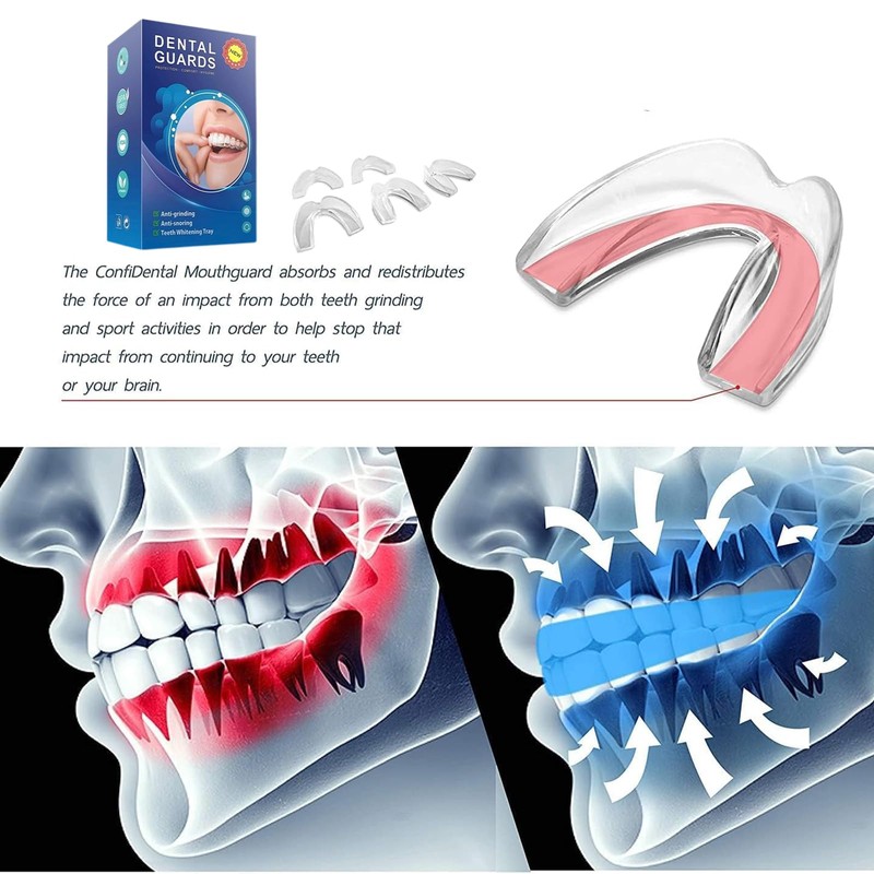 Mouthguard, 2 Pack Mouldable for Bruxism, Teeth Grinding, Athletic Mouth