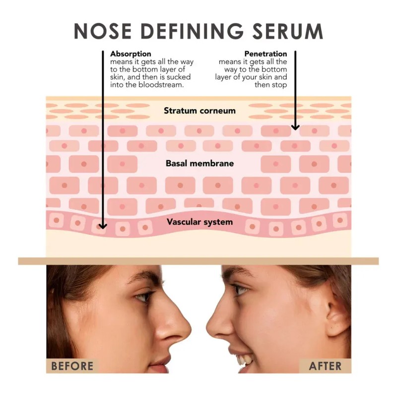 3. Aceite Esencial Para Levantar La Nariz Y Reducir El