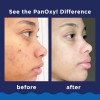 Panoxyl Acné Foaming Wash 10% Peróxido De Benzoilo 156 G