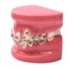 400PCS Small Elastic Bands - Orthodontic Elastic Bands - 3/16