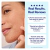 Bliss Jelly Glow Peel™ Exfoliante suave no abrasivo con enzimas