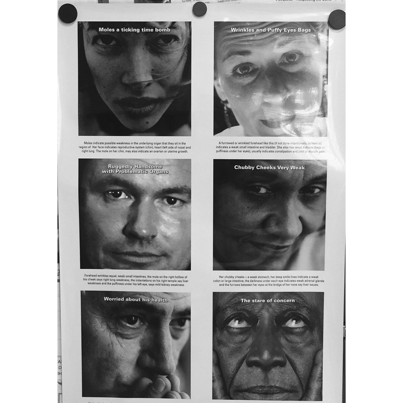 Diagnostic Face Reading Chart - 24" x 36" Two-Sided Office