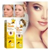 2* Crema Eliminadora De Verrugas Trivializa La Piel Y Las