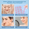 Parches para Acne,Pimple Patch,200 Almohadillas Hidrocoloides para Espinillas, Parches para