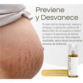Natura Skin Oil 150ml. Aceite Corporal, Disminuye Estrías y Cicatrices, Ideal para Uso durante el Embarazo, Hidrata Profundamente la Piel Seca, No es Grasoso, Con Aceites de Rosa Mosqueta, Aguacate, Almendra, Semilla, Vitamina A, Vitamina E. Skin Care Reafirmante.