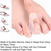 Big Toe Separatoren, 12 Stück Silikon Zehenspreizer für überlappende Zehen,