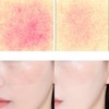 HEVE BLUE Derma Heal Zinc Matcha Recovery BB Cream 30ml,