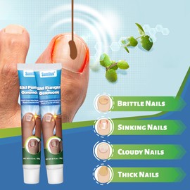 Nail Care Cream for Thick & Damaged Nails – Nail Softening Treatment for Toenails & Fingernails, Nail Surface Repair & Smoothing Formula