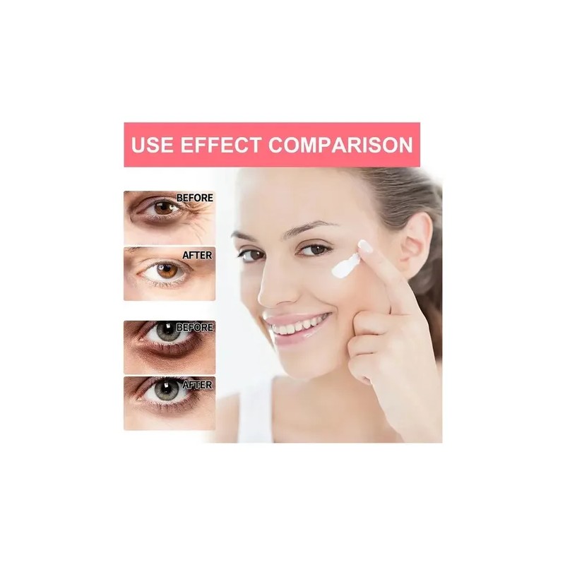 Crema De Ojos Con Retinol Antiedad Hidratante Antiarrugas