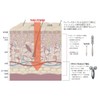 SPLENDORiso Terraloriso Eye II Facial Facial Beauty Device Born from