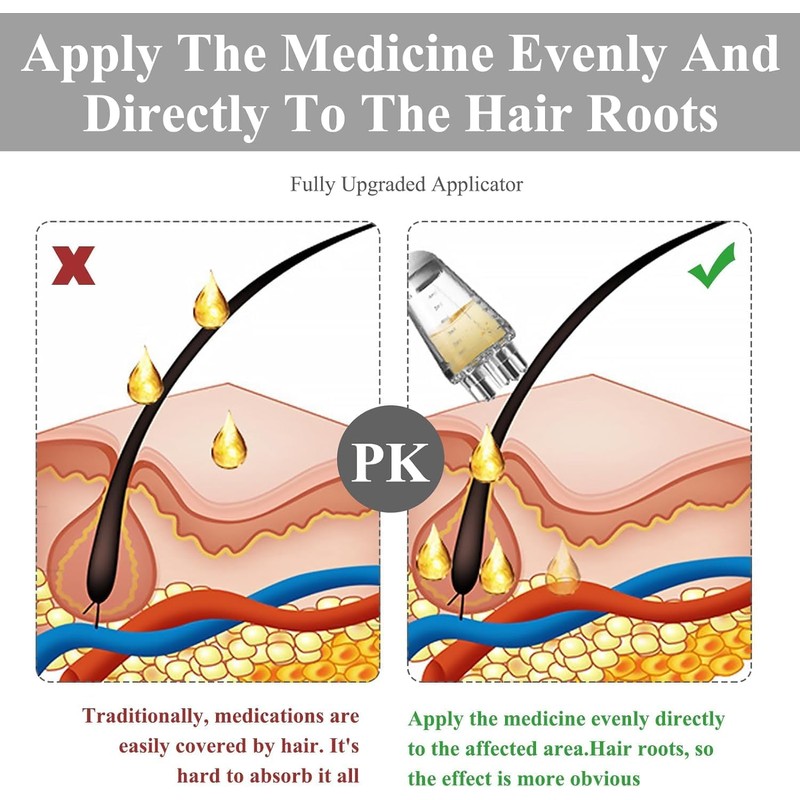 Aceite Para El Cabello Y Cuero Cabelludo Con Aplicador Y
