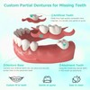 Custom Partial Dentures for Missing Teeth, Removable Dentures for Teeth,