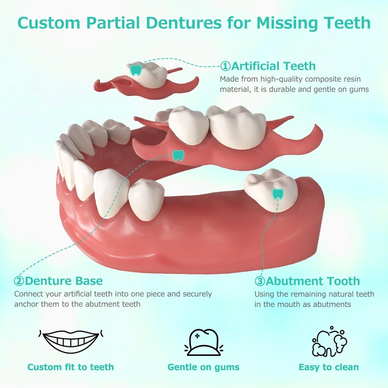 Custom Partial Dentures for Missing Teeth, Removable Dentures for Teeth,
