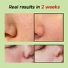 SUNGBOON EDITOR [SUNGBOON EDITOR]Green Tomato Pore Lifting Ampoule+ 30ml