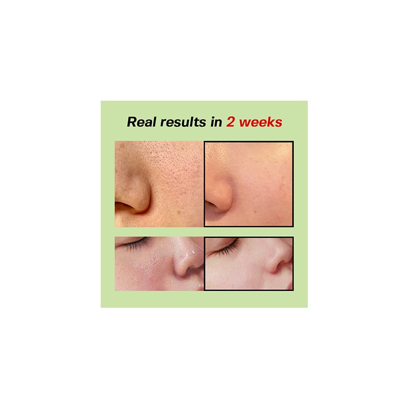 SUNGBOON EDITOR [SUNGBOON EDITOR]Green Tomato Pore Lifting Ampoule+ 30ml