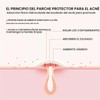 Parches para Espinillas y Acné, para Piel Grasa Mixta o
