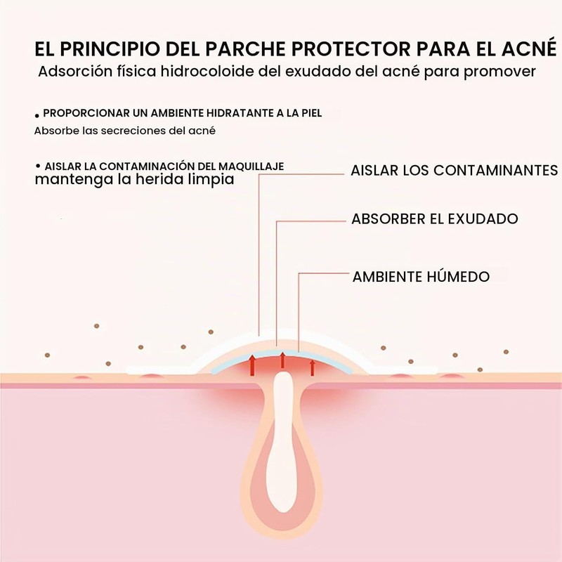 Parches para Espinillas y Acné, para Piel Grasa Mixta o