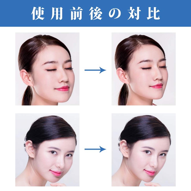 CatMoz Small Face Tape Sagging Wrinkles Nasolabial Line Lift Up