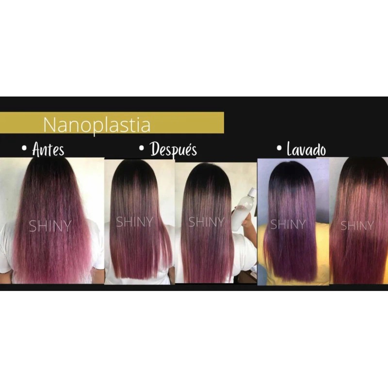 Alaciado Nanoplastia 1 L Kit