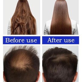 Aceite De Batana De Honduras - Aceite Orgánico Crudo Para El Crecimiento Del Cabello, Repara El Cabello Dañado, Deja El Cabello Más Suave (2Oz)