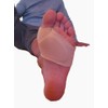 FlexaMed Metatarsal Foot Sleeves (Left and Right Foot - Pair)