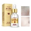 Serum Crema Cerrar Poros Anti Puntos Control Grasa Acné Normal