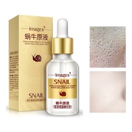 Serum Crema Cerrar Poros Anti Puntos Control Grasa Acné Normal