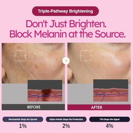 BRIGHT124 Alpha Arbutin TXA Crema con niacinamida, vitamina C y ácido hialurónico para un tono uniforme de la piel, imperfecciones, cuidado de la piel