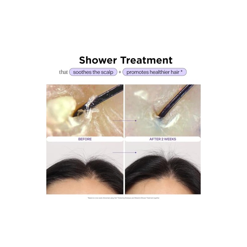 Dr. Groot Miracle in Shower Treatment for Hair Loss -