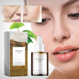 Centella Serum for Face – Soothing Hydrating Facial Serum with Madecassoside – Lightweight Non-Greasy Essence for Sensitive & Dry Skin – 30ml