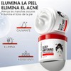 2PC Crema de ácido kójico, crema facial para pecas, crema