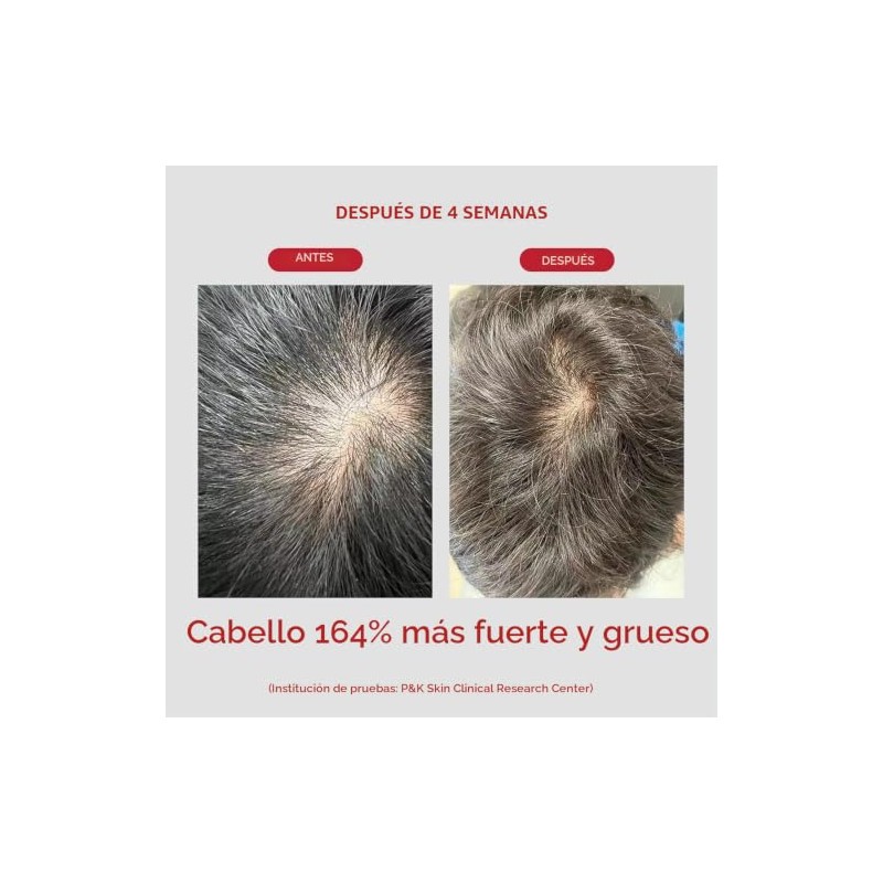 Moev Annurcatin™ Shampoo- 300ml | Annurca Apple Extract + Biotin