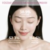 Forehead Facial Anti Wrinkle Patches: Soften Gentle Forehead Age 25-35