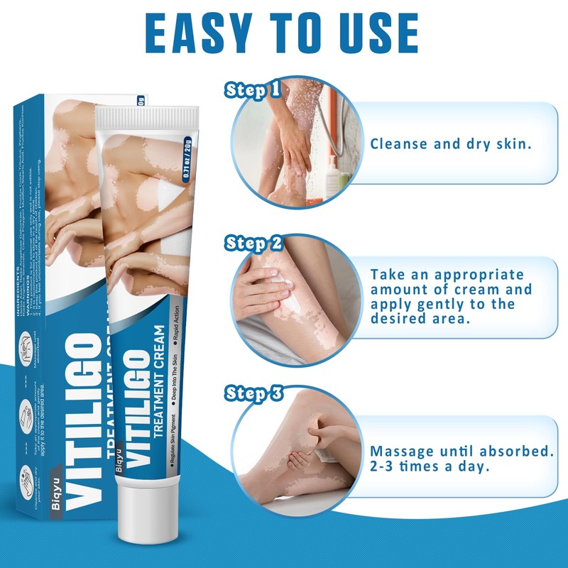 Biqyu Biqyu Vitiligo Treatment Cream, Effective Vitiligo Treatment, Improve Skin