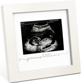 KeaBabies Baby Sonogram Picture Frame - Modern Ultrasound Picture Frames for Mom to Be, First Pregnancy Gifts for Expecting Mom & First Time Dad, Baby Gender Reveal Gifts (Alpine White)