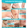 2026 Upgrade Hydrocolloid Roll for Wound Care, 2in*16.4ft Cuttable Hydrocolloid
