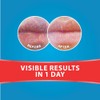 Dermal Therapy Lip Balm Tube (6 Pack, Mint)