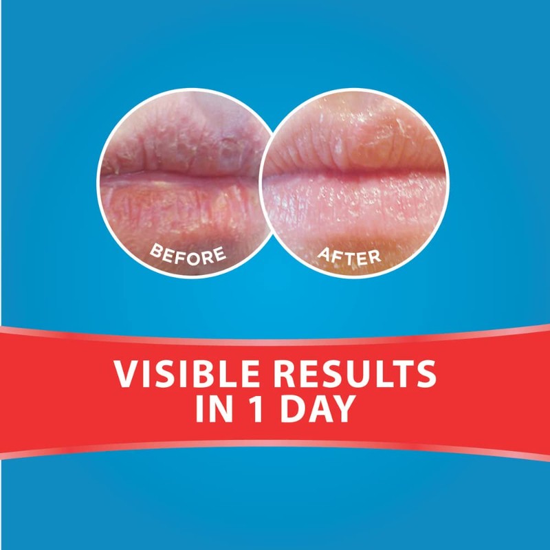 Dermal Therapy Lip Balm Tube (6 Pack, Mint)
