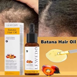 LEWEDO 2Pack Natural Batana Oil For Hair Growth Healthier Thicker Fuller Anti Hair Loss