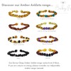 Baby J's - Honey Coloured Bracelet/Anklet - Premium Amber Bracelet