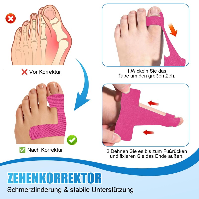 Hallux Valgus Kinesiotape, 60 Pre-Cut Hallux Valgus Tape