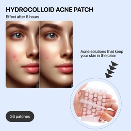 Custom Hydrocolloid Pimple Patch – Targeted Acne Cover for Skincare and Beauty. Acne Patch (pack of 2)
