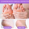 QOCUILC 2 Paia maschera piedi secchi screpolati, Maschera piedi esfoliante,